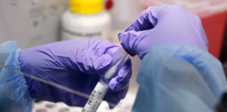 Navajo Nation reports another 160 COVID cases plus 4 deaths